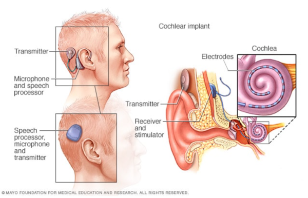 (Photo source: Mayo Foundation for Medical Foundation and Research)